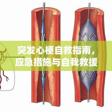 突发心梗自救指南，应急措施与自我救援方法